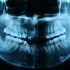 Praxis für Zahnheilkunde, Michael Meurer Rheinbach